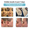 SkinClear Pro™ - Erase Embarrassing Skin Blemishes Forever (+ FREE Mystery Gift)