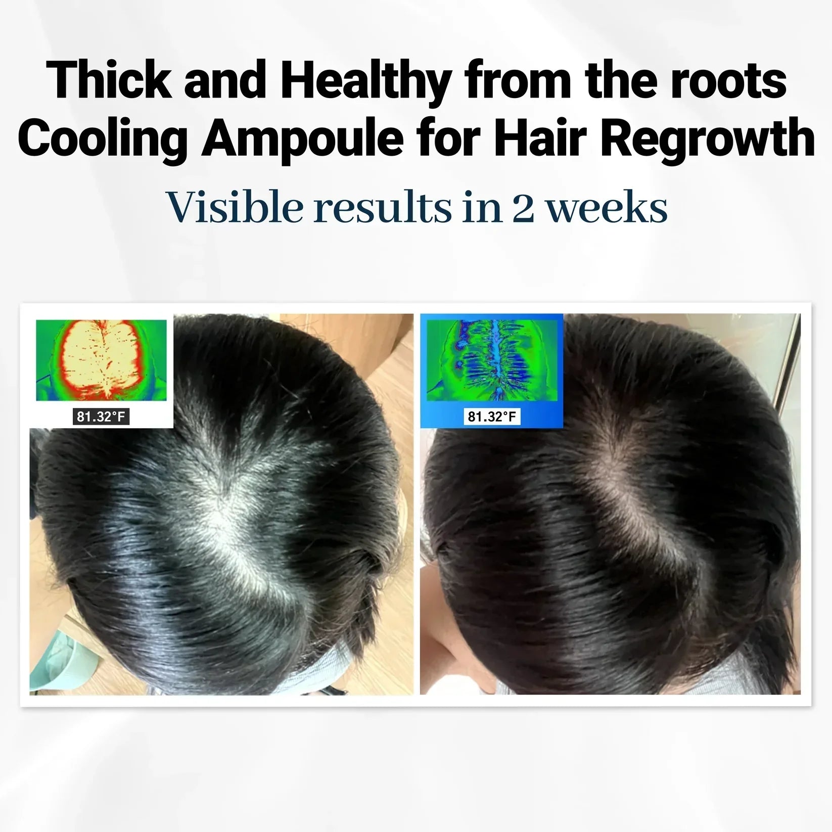 FolicleRevive™ - Korean Hair Growth Breakthrough That Regrows Lost Hair in Just 3 Weeks (+ FREE Annual Planner | 50 pages)