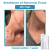 SkinClear Pro™ - Erase Embarrassing Skin Blemishes Forever (+ FREE Mystery Gift)