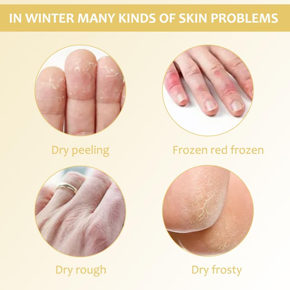 SkinSoothe™ - Transforms Dry, Cracked Skin Into Silky Smooth Perfection (+ FREE Mystery gift)