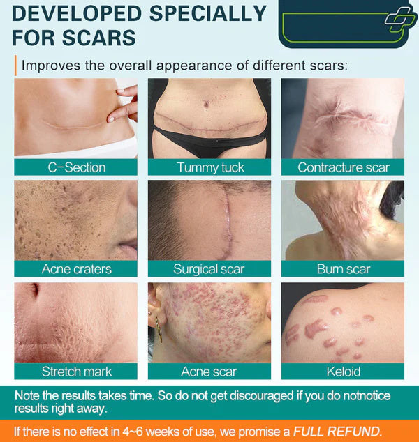 Scar-Free Skin, Faster Than Ever – The Ultimate Advanced Scar Spray