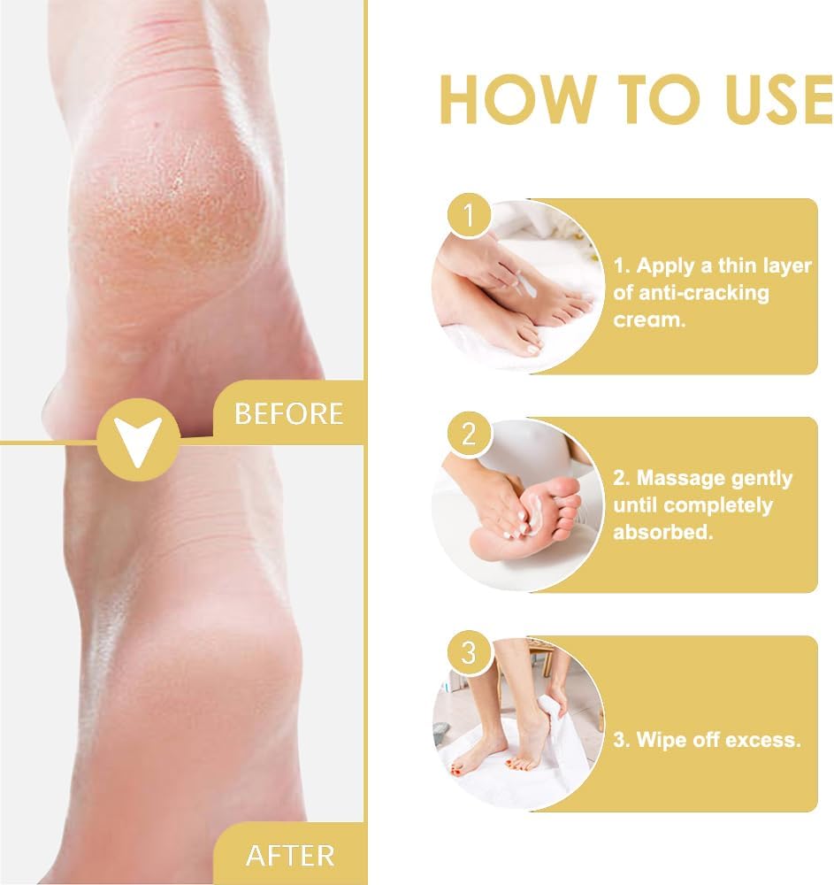 SkinSoothe™ - Transforms Dry, Cracked Skin Into Silky Smooth Perfection (+ FREE Mystery gift)