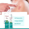 Scar-Free Skin, Faster Than Ever – The Ultimate Advanced Scar Spray