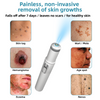 SkinClear Pro™ - Erase Embarrassing Skin Blemishes Forever (+ FREE Mystery Gift)