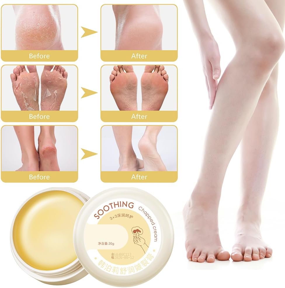 SkinSoothe™ - Transforms Dry, Cracked Skin Into Silky Smooth Perfection (+ FREE Mystery gift)