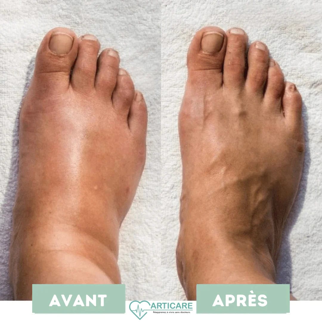 CircuFlow™ - Revitalise Tired, Aching Feet in Just 15 Minutes (+ FREE Mystery Gift)