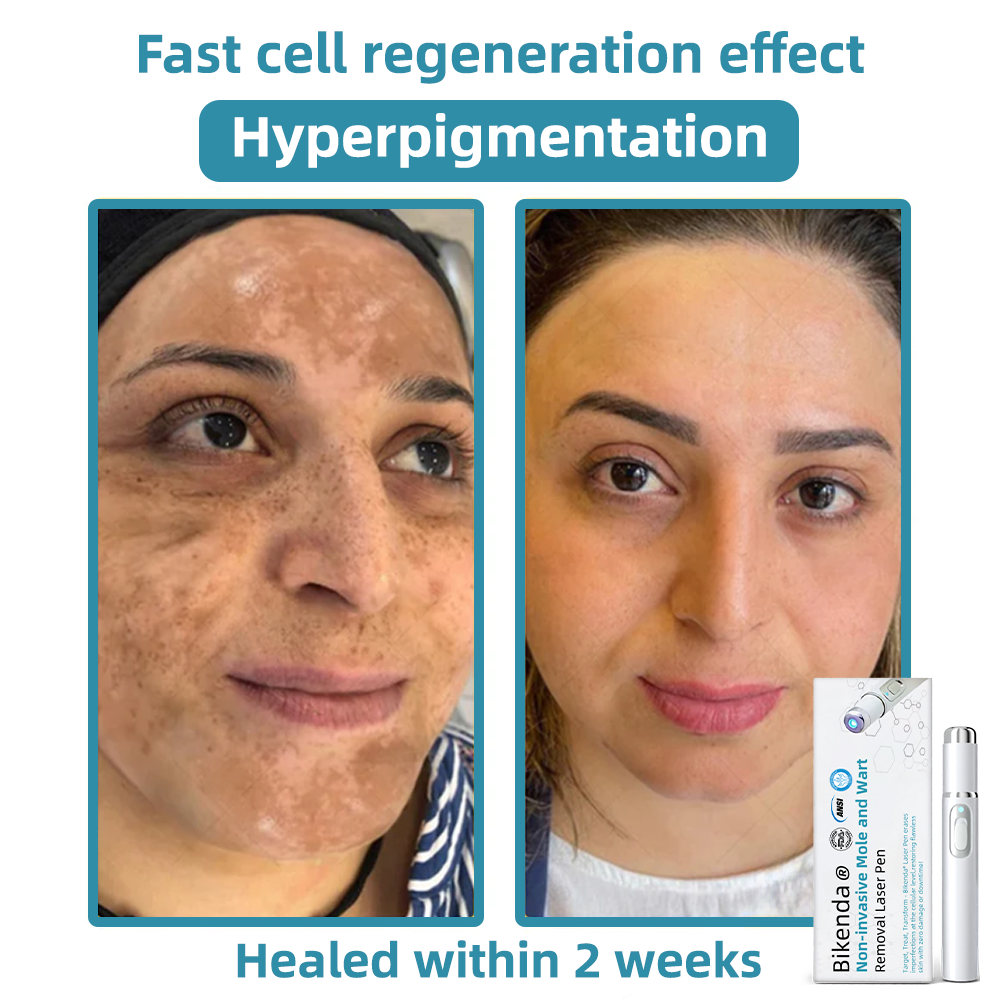 SkinClear Pro™ - Erase Embarrassing Skin Blemishes Forever (+ FREE Mystery Gift)