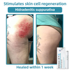 SkinClear Pro™ - Erase Embarrassing Skin Blemishes Forever (+ FREE Mystery Gift)