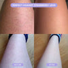 SilkTrim Pro™ - Get Salon-Smooth Legs in 60 Seconds (+ FREE Mystery bonus)