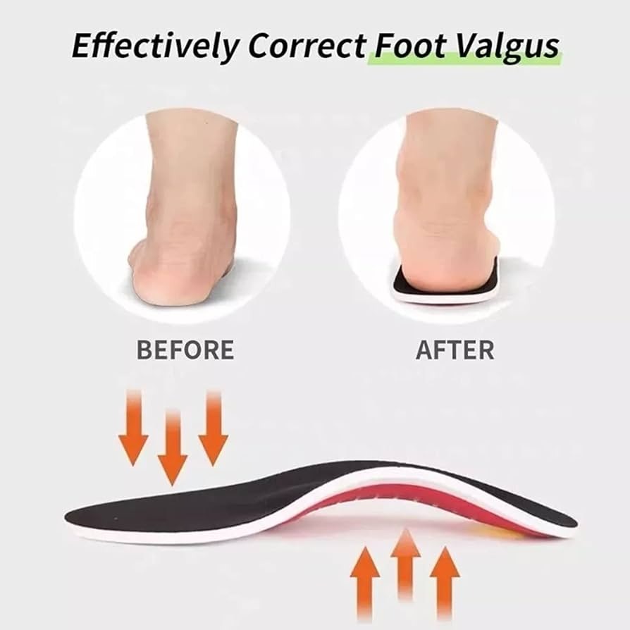 (50% OFF) | OrthoRelief™ - German-Made Arch Support Insoles | Pain Relief for Feet, Knees, and Back