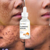 Sauvasine™ - Dark Spot Corrector Serum (DISCOUNTED)
